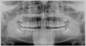 Good quality X-ray