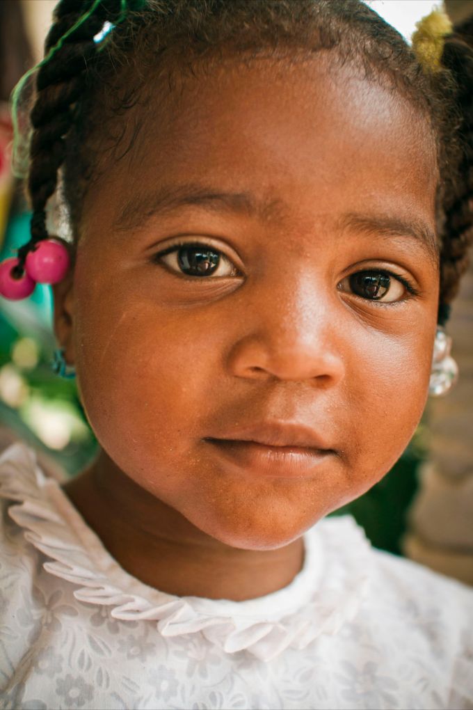 Child with a neutral expression - Dental Mission in the Dominican Republic